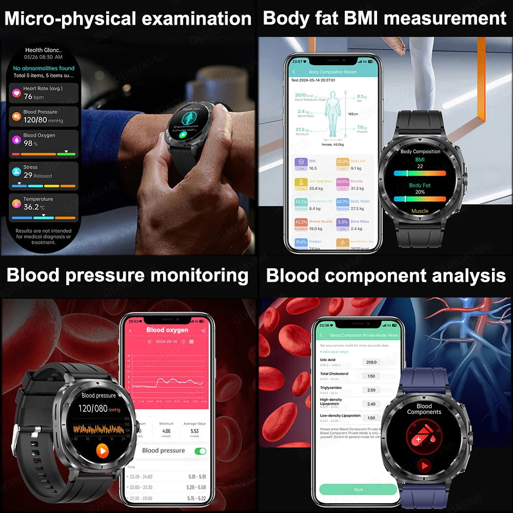 2025 NEW Health monitoring ECG+PPG Smart Watch Uric Acid Blood fat Blood Pressure High Precision Analysis Smart Watch Voice call