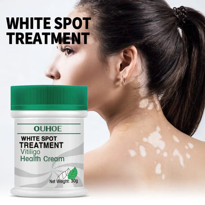 30g White Spot Treatment Disease Cream Ointment Leukoplakia Repair Vitiligo Pigment Melanin Skin Care Beauty Health Maquiagem