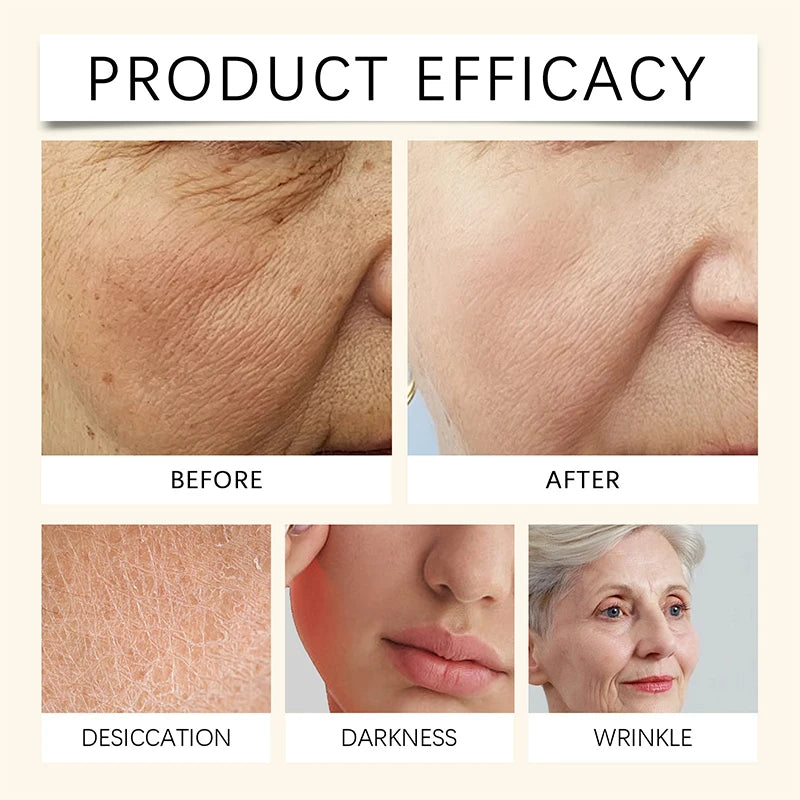 Korean Collagen Niacinamide Skin Care Tallow Honey Balm Moisturizing Cream Set Deeply Nourish Suitable For Dry Rough Skin Cream