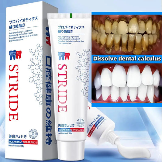 Remover Dental Calculus Toothpaste Preventing Periodontitis Whitening Teeth Efficient Mouth Odour Removal Bad Breath Fresh Oral