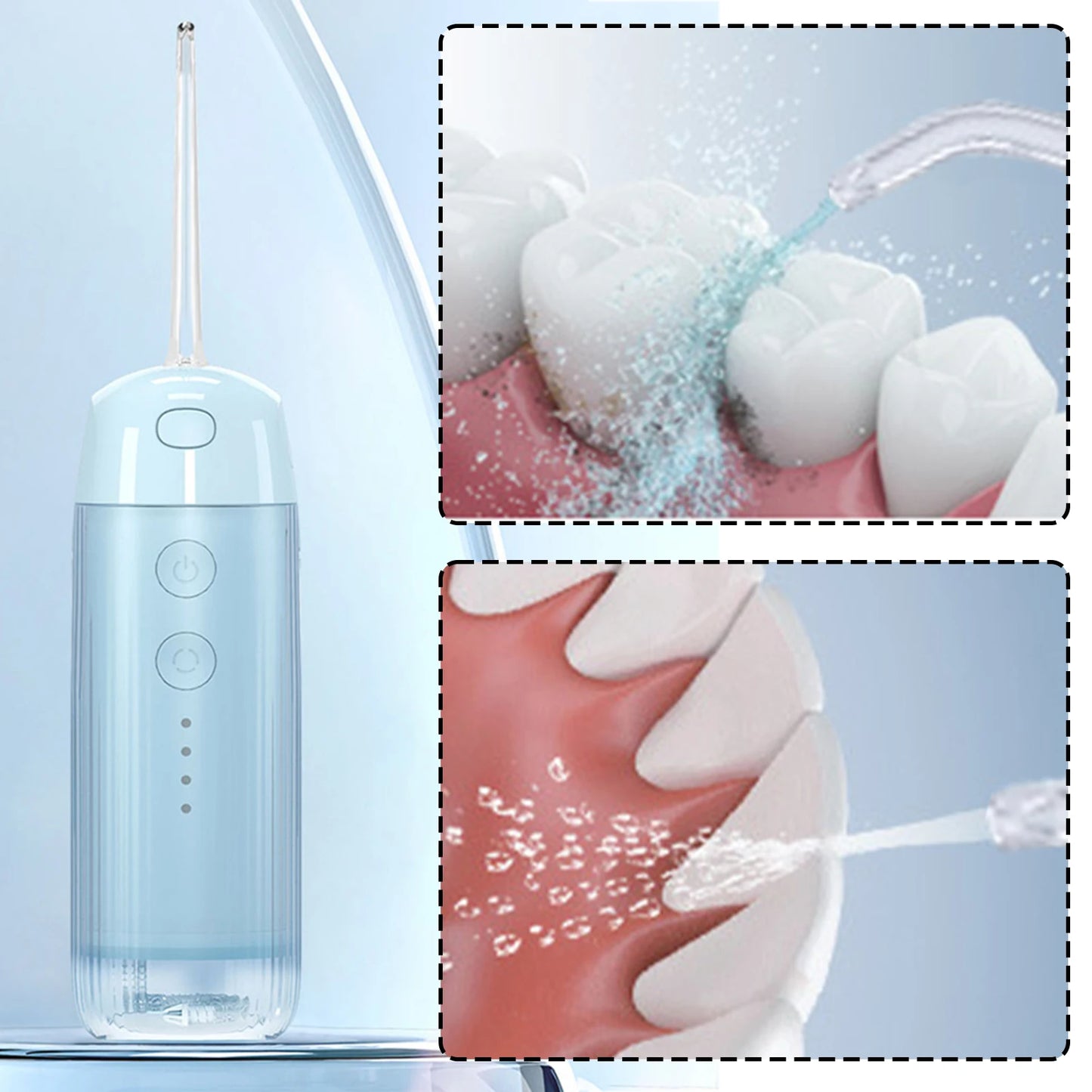 Electric High-Frequency Oral Irrigator IPX7 Waterproof Beauty Instrument Tooth Cleaner All Around Oral Teeth Cleaning Care Tool