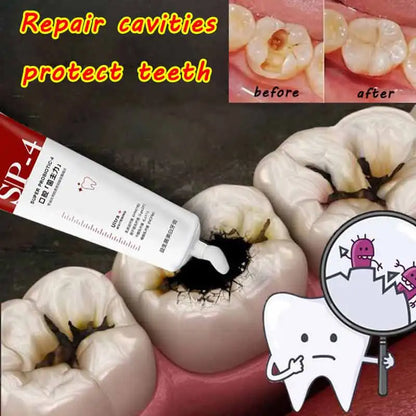 Repair of Cavities Caries Removal of Plaque Stains Decay Whitening Yellowing Repair Teeth Teeth Whitening 2023 New toothpaste