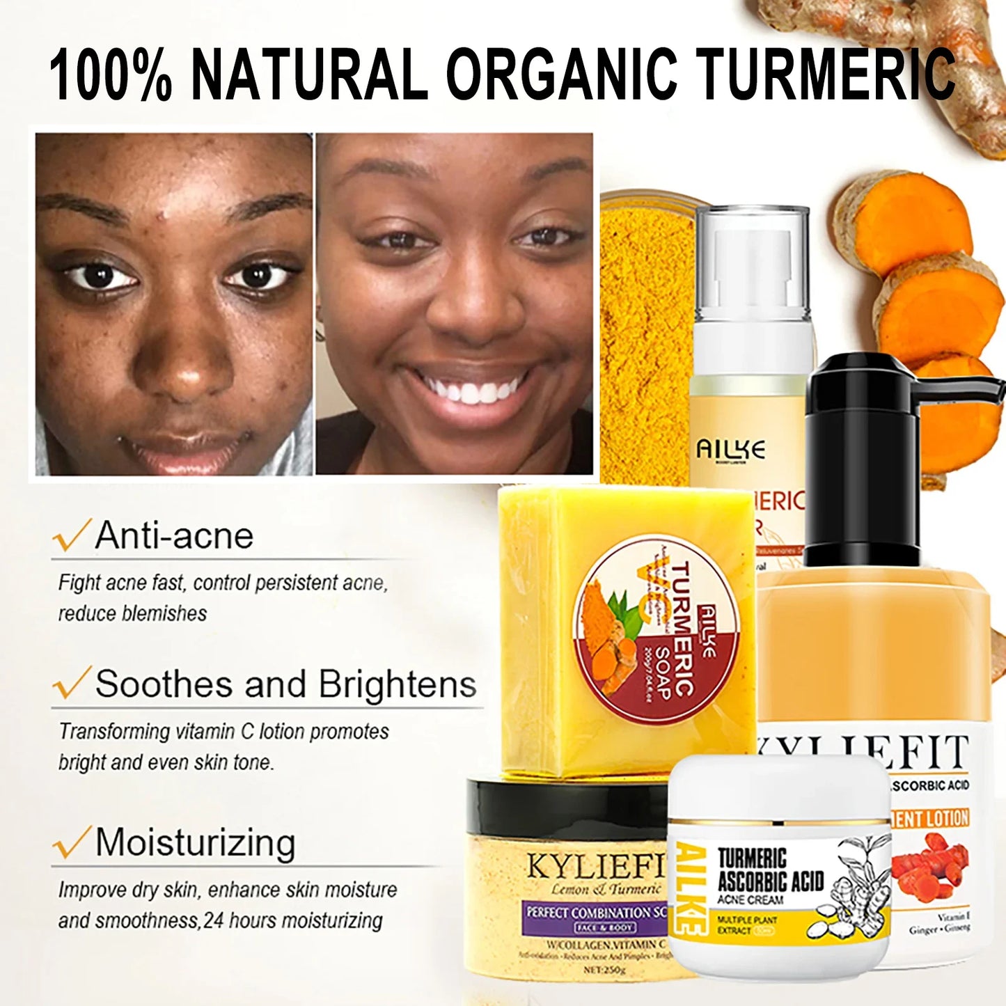 AILKE Natural Turmeric Skin Care Range, Lightening, Cleaning Skin, Moisturizes, Remove Acne and Pimples, Refining Pores