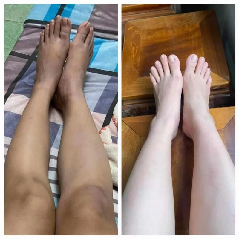 Kem Body Sữa Dưỡng Kích Trắng Teacos 200g,  Remove Dark Skin Blemishes, Lightening Nourishes Bright White Skin Shine Naturally